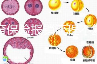 生育保險報銷流程不復雜，辦理地點不分地域異地可報銷