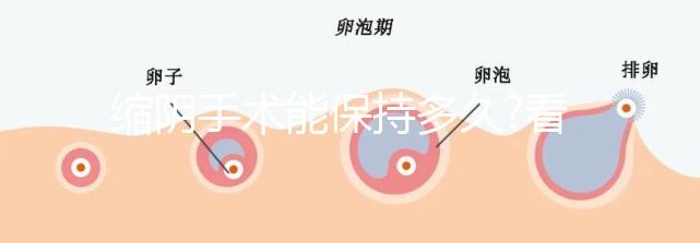 縮陰手術(shù)能保持多久?看看做過的人怎么說