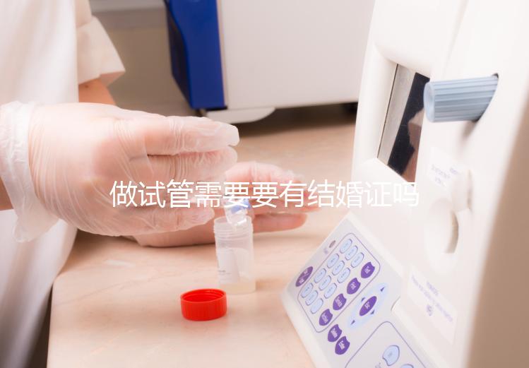 做試管需要要有結婚證嗎?做試管需要結婚證