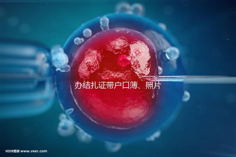 辦結扎證帶戶口簿、照片作用不大，要一樣就足夠~