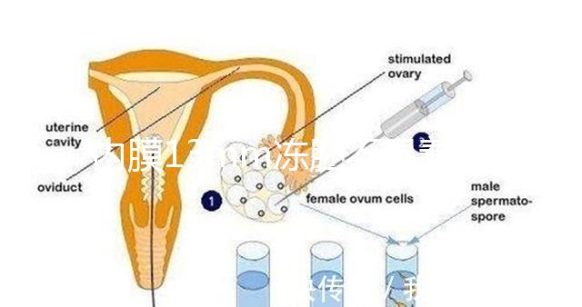 內膜13mm凍胚不易著床要注意,移植與否看醫(yī)生怎么說