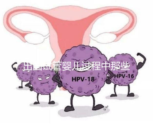 出國試管嬰兒過程中那些困惑,12個常見問題釋疑