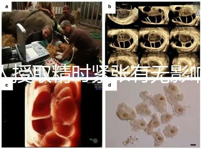 人授取精時緊張有無影響別還不造，注意事項不少不可不知