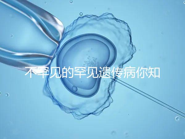 不罕見(jiàn)的罕見(jiàn)遺傳病你知道嗎？帶你認(rèn)識(shí)下特納綜合癥