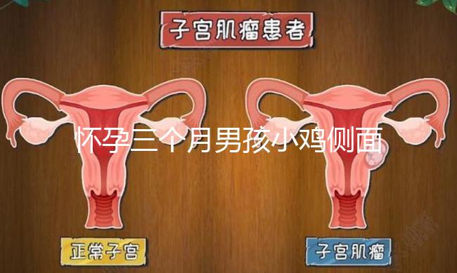 懷孕三個月男孩小雞側面二維b超圖片分享，原來兩腿間有尖