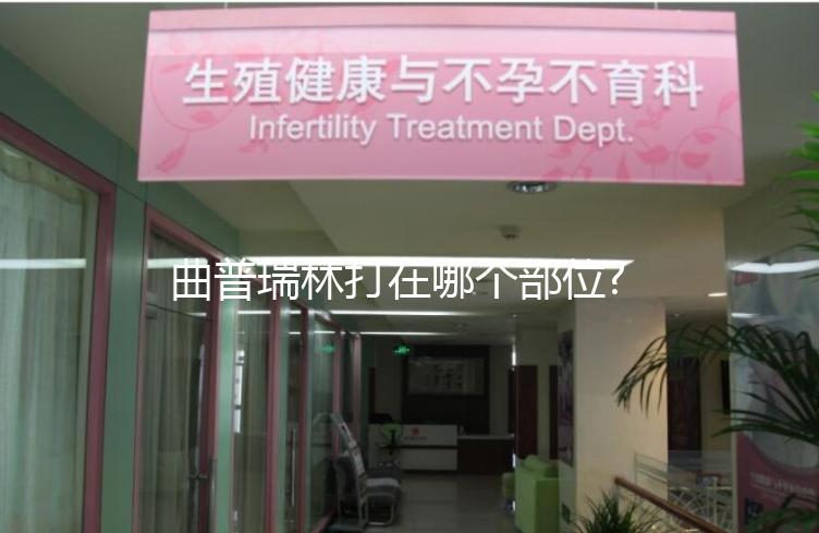 曲普瑞林打在哪個部位?5步完成自己注射,快來學一學!