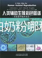 水解蛋白奶粉哪種好?口感和消化分析這個(gè)品牌出彩