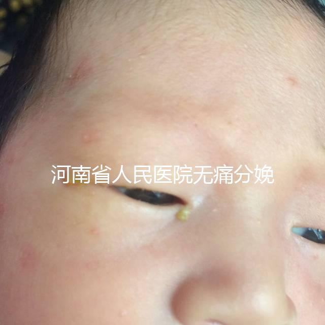 河南省人民醫(yī)院無(wú)痛分娩多少錢(qián)戳,收費(fèi)標(biāo)準(zhǔn)60s看懂不踩坑