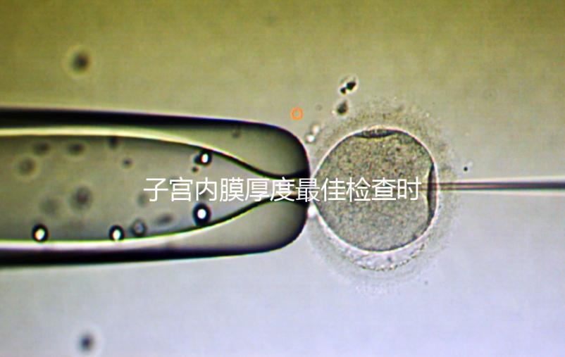 子宮內(nèi)膜厚度最佳檢查時(shí)期，你有必要提前知道！