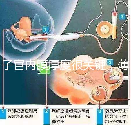 子宮內膜厚度很關鍵,薄了厚了試管嬰兒都難成功