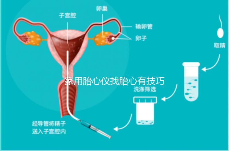 家用胎心儀找胎心有技巧，飯后半個(gè)小時(shí)測(cè)準(zhǔn)確率稍高