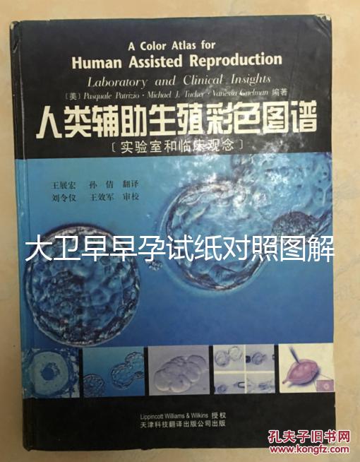 大衛(wèi)早早孕試紙對(duì)照?qǐng)D解，教你怎么看結(jié)果是不是陽(yáng)性