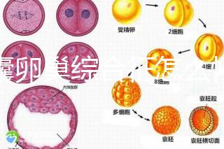 多囊卵巢綜合征怎么懷孕？試管嬰兒并不是唯一方案