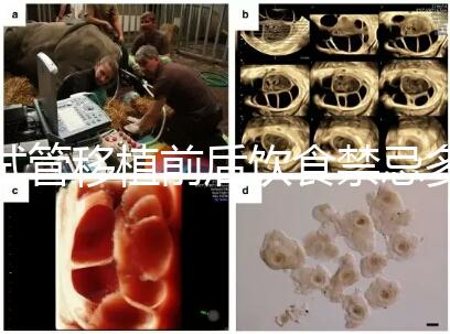 試管移植前后飲食禁忌多，十大不利于胚胎著床的水果別亂吃