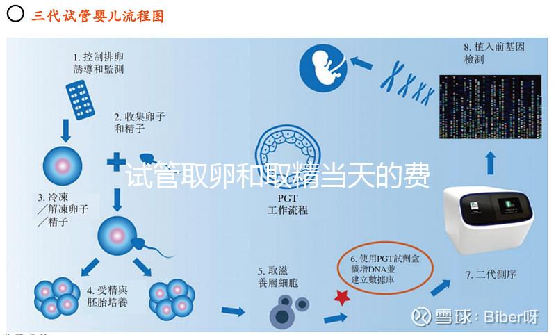 試管取卵和取精當天的費用明細表，大概多少錢一清二楚