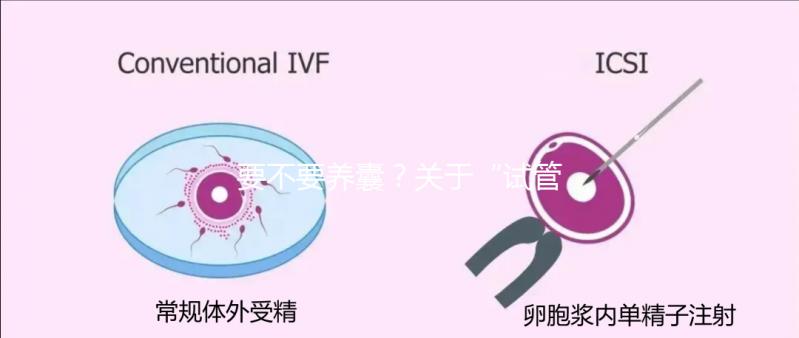 要不要養囊？關于“試管養囊”你是否會有很多問號？